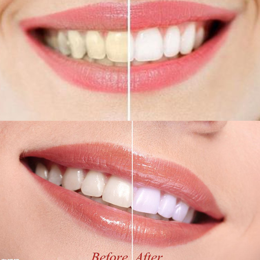 Бамбуковый уголь для зубов, ст – обзор и цена Teeth Whitening Levels