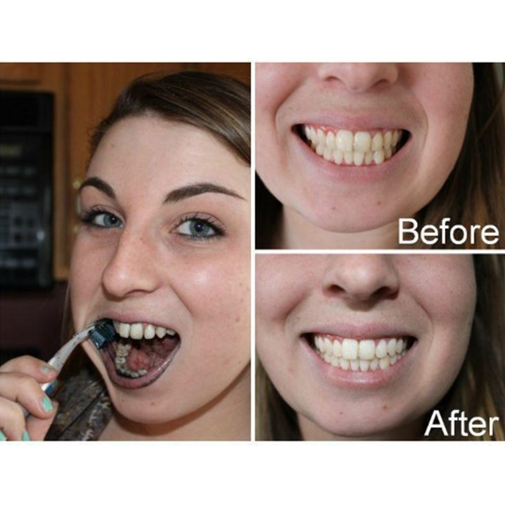 Бамбуковый уголь для зубов, ст – обзор и цена Teeth Whitening Levels