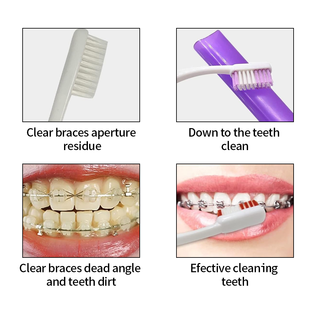 8 шт./компл., набор ортодонтич – обзор и цена Teeth Whitening For Braces
