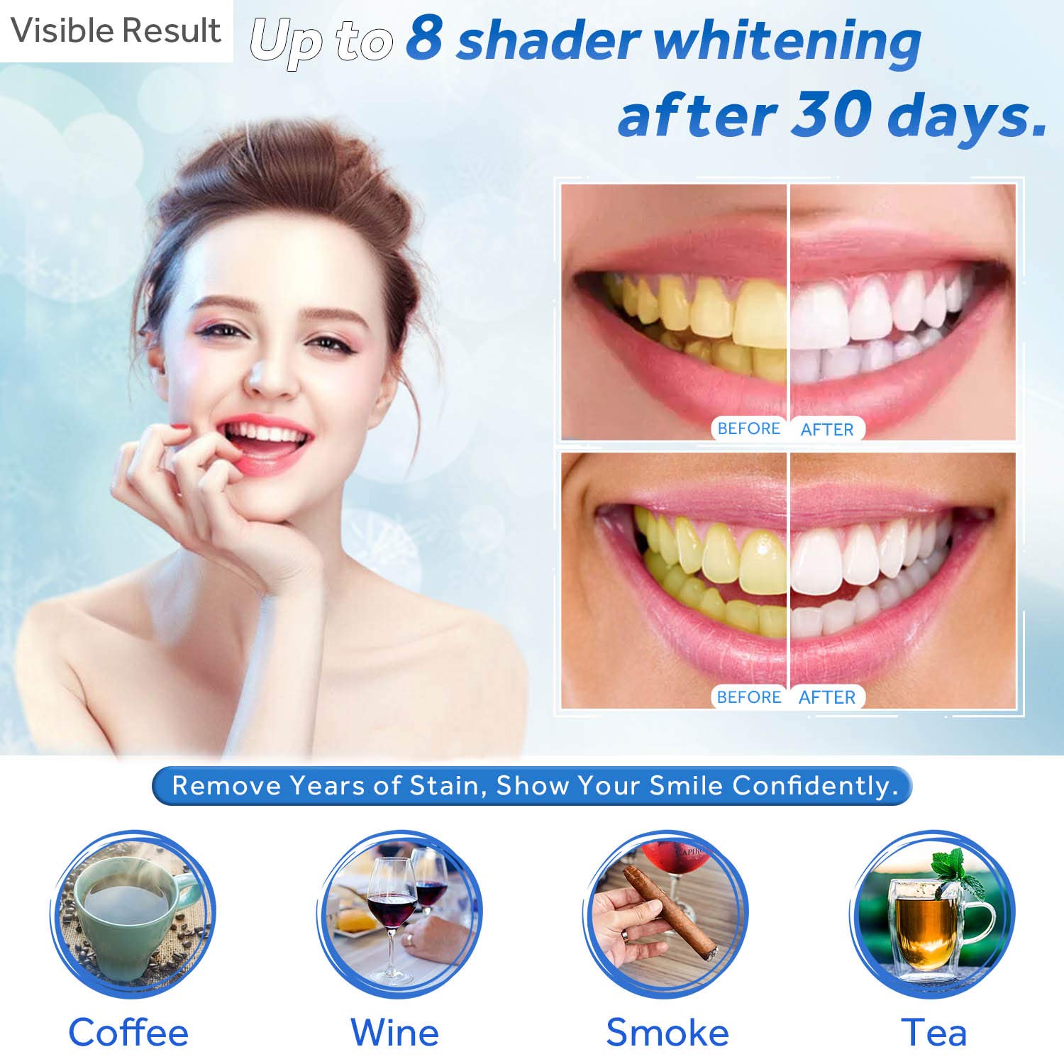 Гель для отбеливания зубов, шп – обзор и цена Teeth Whitening Bleaching Kit