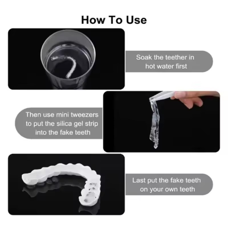 Виниры для отбеливания зубов,  – обзор и цена Teeth Whitening For Braces