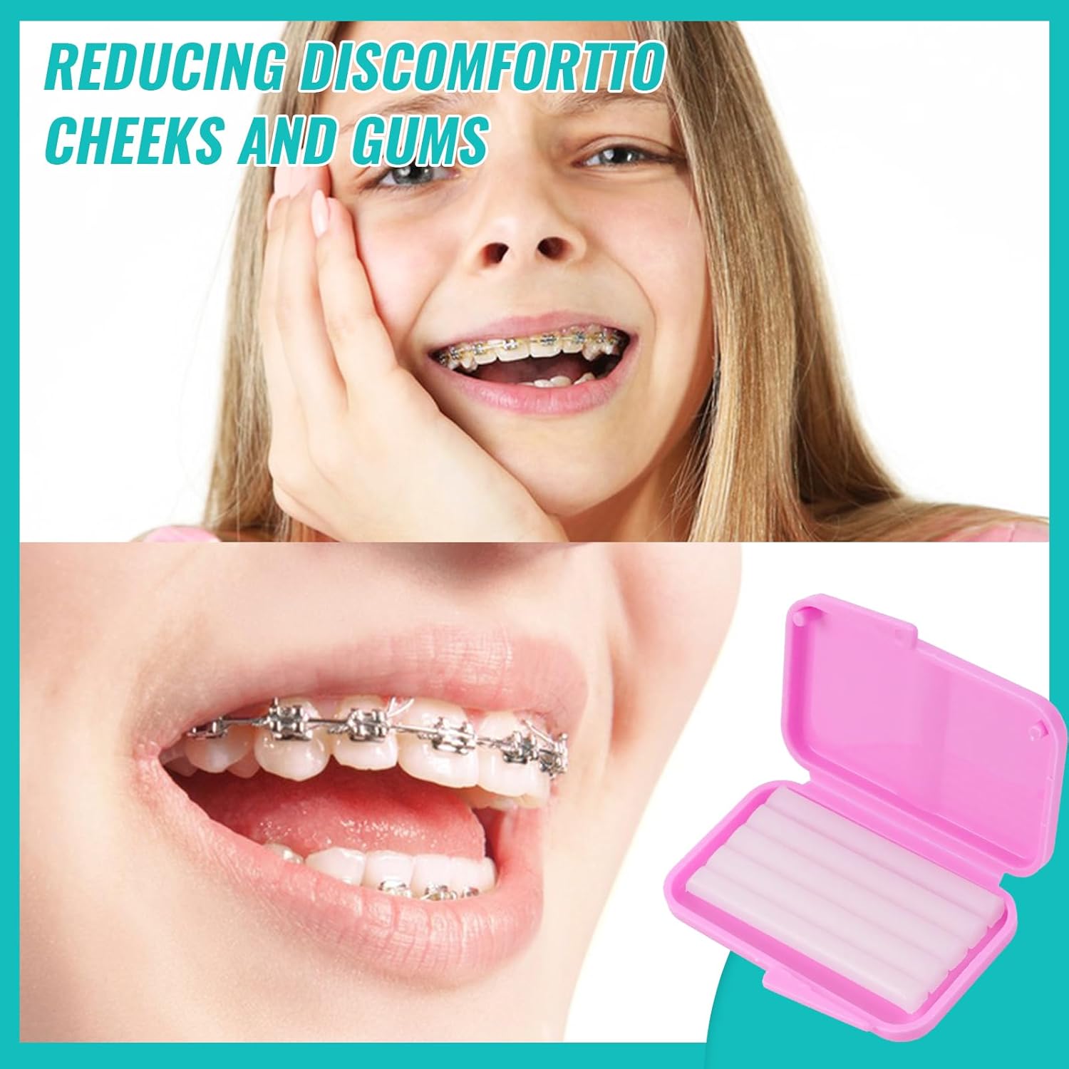 10 коробок стоматологический о – обзор и цена Teeth Whitening For Braces