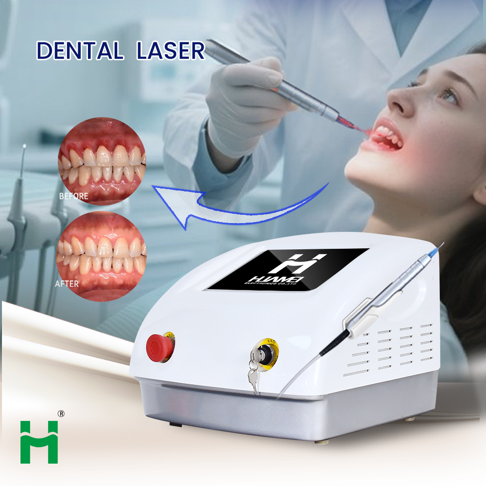 Портативный набор для отбелива – обзор и цена Teeth Whitening Bleaching Kit
