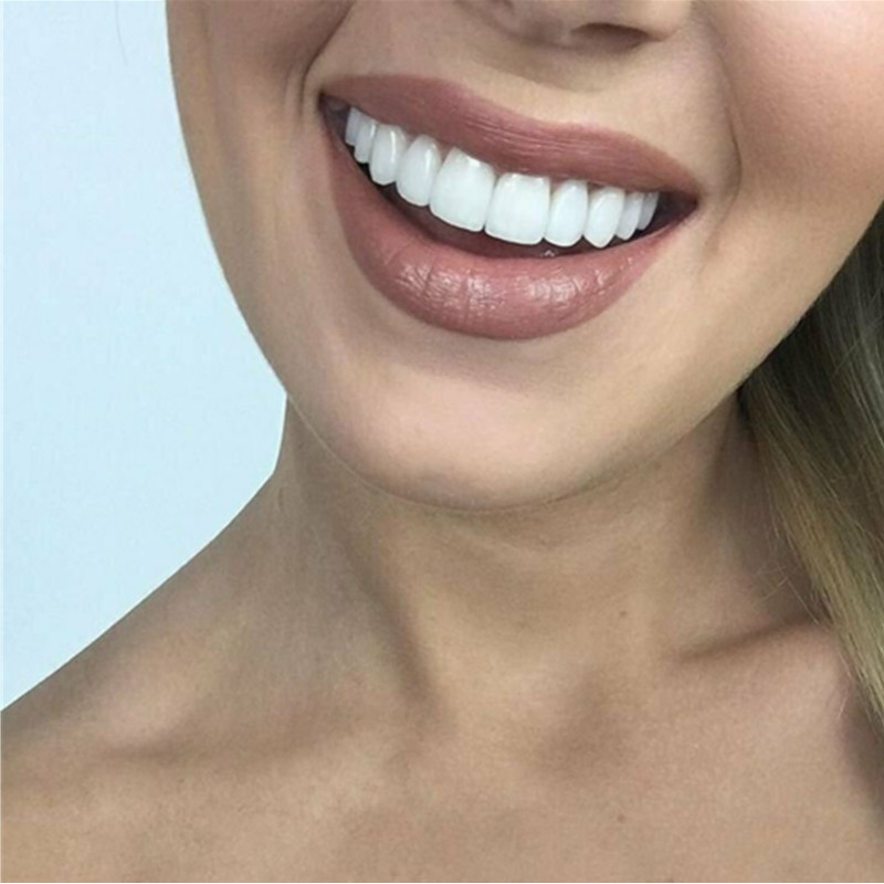 Временные отбеливающие виниры  – обзор и цена Teeth Whitening For Braces