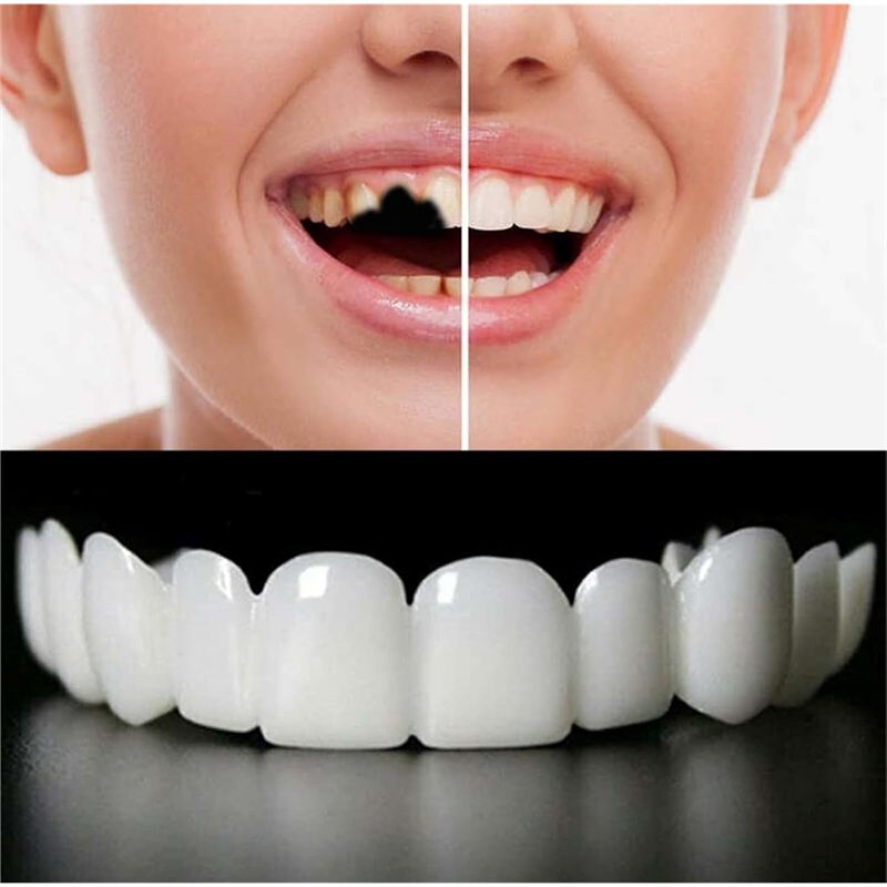НОВИНКА! ABMK】 2 пары, для вос – обзор и цена Teeth Whitening For Braces