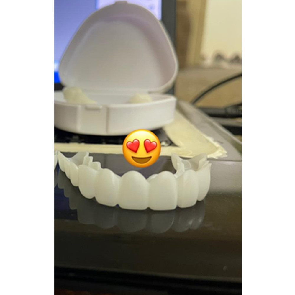 Накладные зубные протезы On Sm – обзор и цена Teeth Whitening For Braces